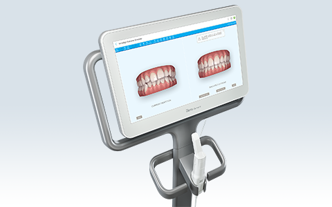 口腔内スキャナiTero（アイテロ）